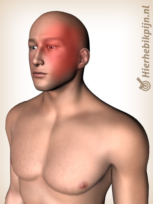 tête maux de tête migraine localisation de la douleur