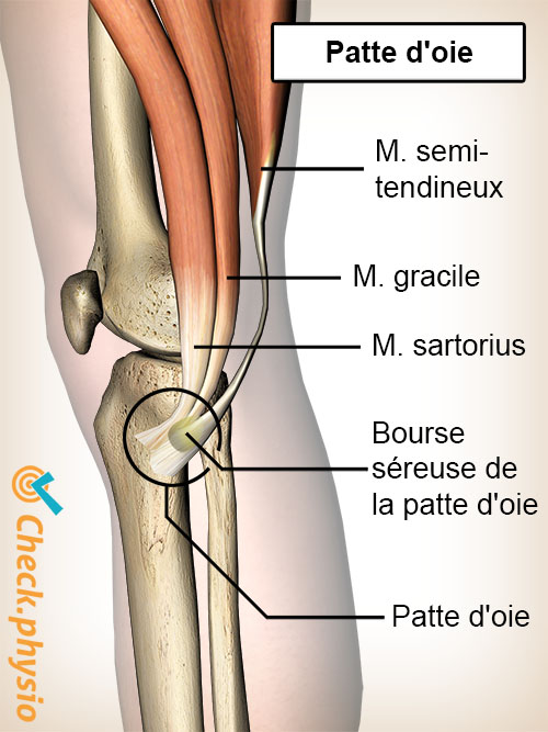 genou bourse pes anserinus sartorius gracilis semi tendineux tendons patte d'oie syndrome