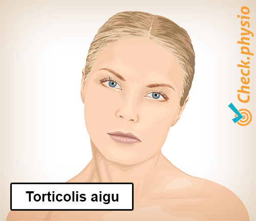 torticolis du cou posture anormale