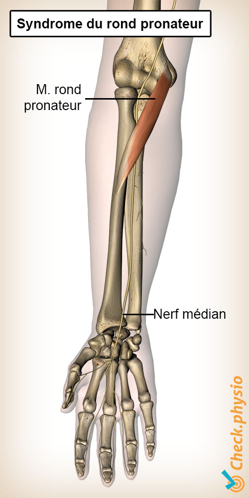 avant-bras syndrome du rond pronateur muscle nerf médian