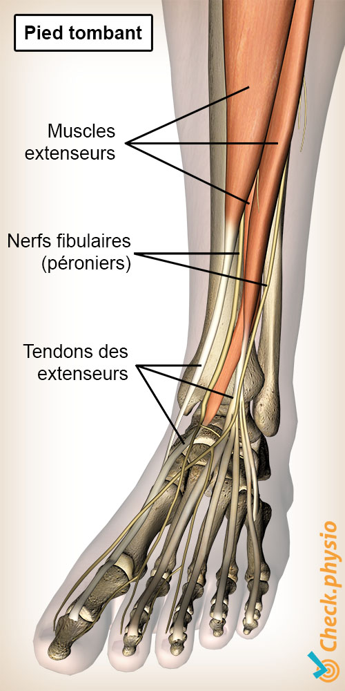 jambe inférieure pied tombant nerfs péroniers releveurs du pied muscles tendons