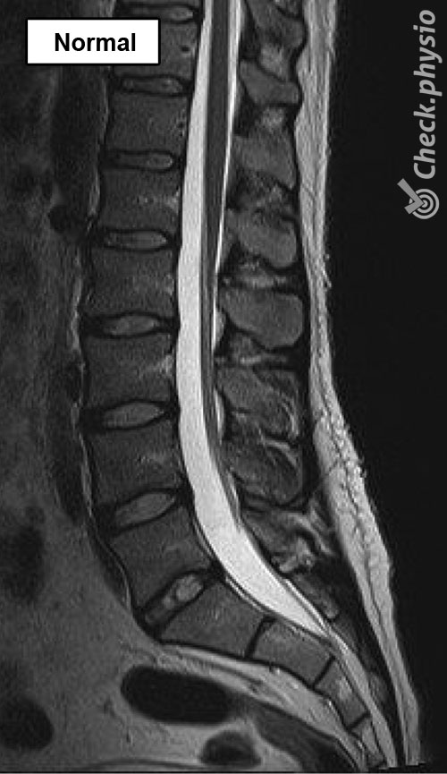 dos colonne lombaire radiographie normale