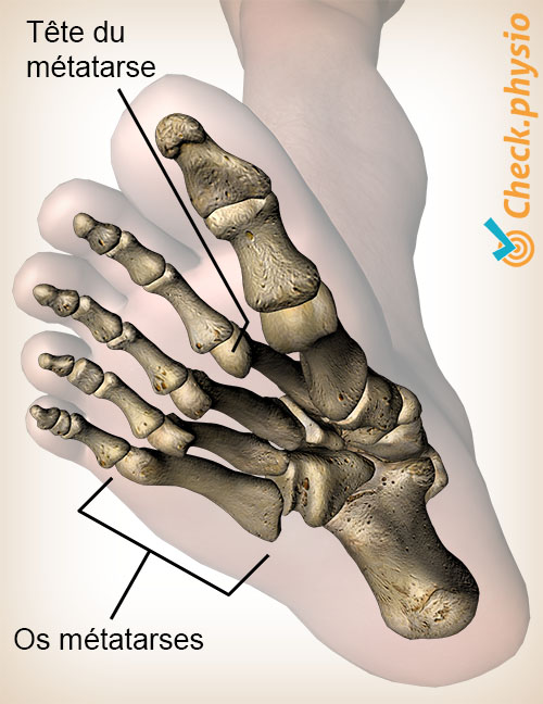 pied métatarsi tête métatarsien anatomie vue inférieure