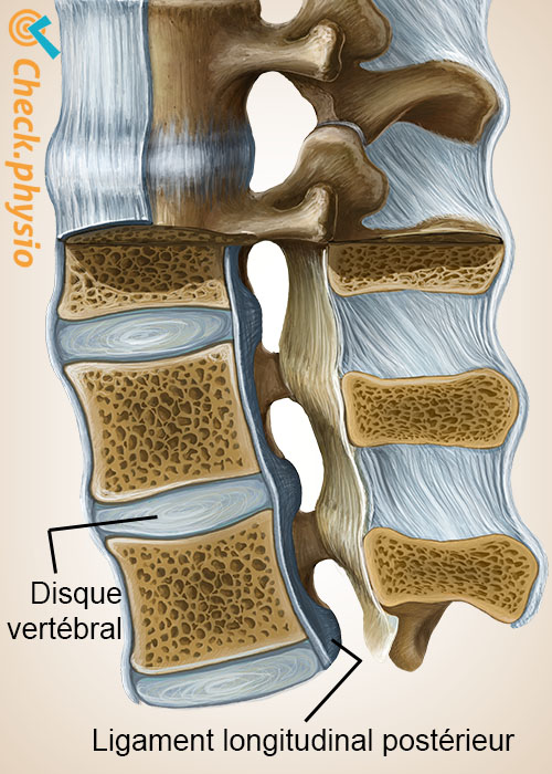 colonne vertébrale ligament longitudinal postérieur disque intervertébral
