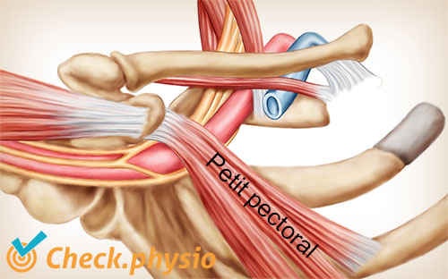 épaule bras main syndrome du défilé thoracique petit pectoral