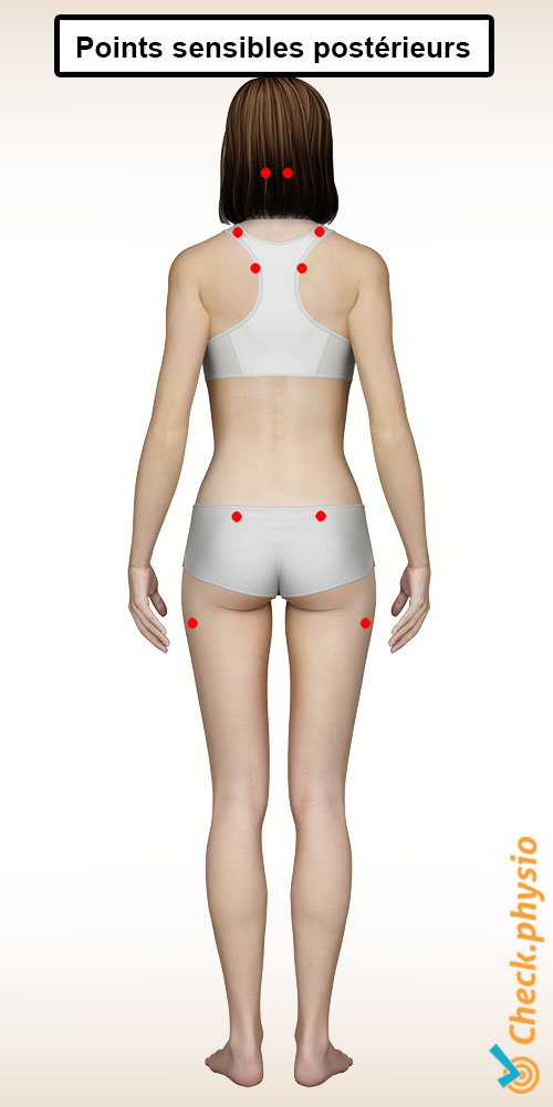 fibromyalgie points sensibles arrière