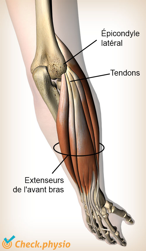 bras extenseurs