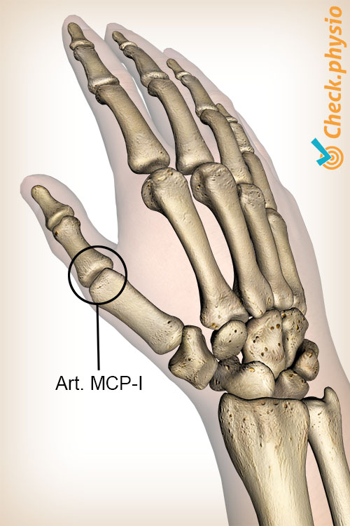 main MCP 1 pouce